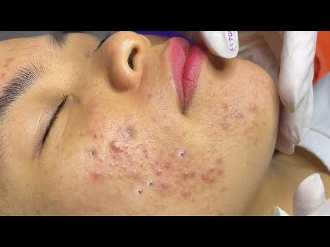 Satisfying With Loan Nguyen Spa Video #001