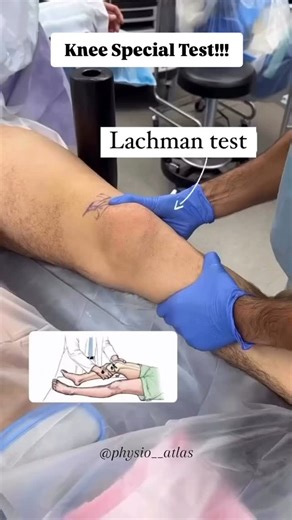 Dr. physio🎓 on Instagram: "📍Knee Special Tests 📍 🔺️ACL & MCL Evaluation🔺️ ✅️Lachman ✅️Anterior Drawer ✅️Valgus Stress Test . . . #physiostudent #physio #physio__atlas #specialtests #kneepain #knee #kneeinjury #kneeligamentinjury #aclinjury #ligamentinjury #rehab #physiotherapist #physicaltherapy #clinicalorthopedics #clinicalpractice"