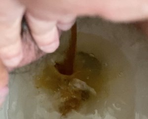 Diarrhea and Sighing