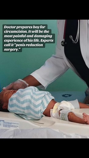 penis reduction surgery on newborn boy. #circumcision | Brother K