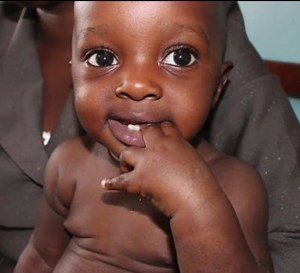 UVA Radiology Resident International Education Program - Radiology and Medical Imaging