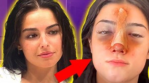THIS is why TikTok star #CharliD'Amelio had SURGERY & #AddisonRae SECRET podcast revealed! | AwesomenessTV