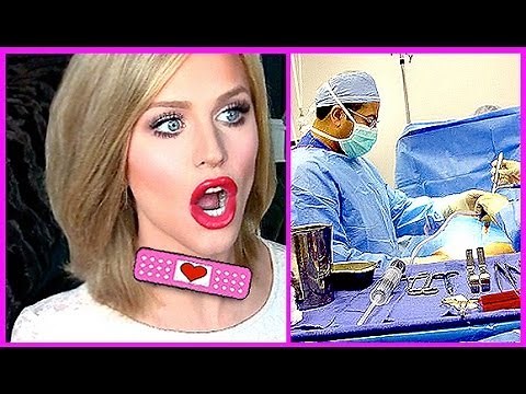 MY PLASTIC SURGERY EXPERIENCE | Gigi