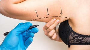 What's the difference between liposuction and fat freezing? Here's what to know
