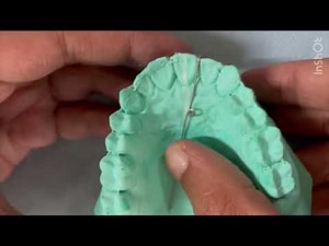 Finger Spring Fabrication || Wire Bending || Orthodontics || Step by Step