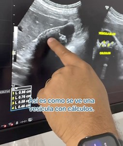 280 reactions · 29 shares | ECOTOMOGRAFÍA (ECOGRAFÍA) DE ABDOMEN Y...