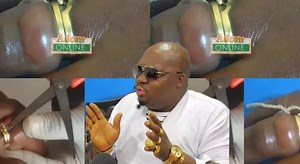 1.8K views · 78 reactions | Secret behind is out: Woman who almost lost her finger after wearing wedding ring bought..... | KarmaPresident | Facebook