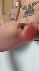 2l glucose infusion timelapse in scrotum