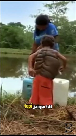 Turtle Shell-Like Skin (Real Case)