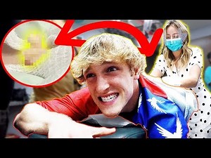 GIRLFRIEND POPS MY BACK CYST! **graphic**