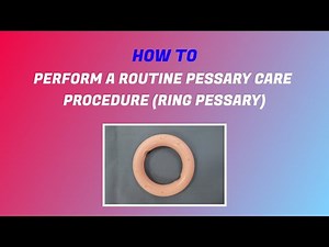 How to perform a routine pessary care procedure