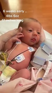 #nicu #nicumom #tinybutmighty #preemie #34weeks #prematurebaby | Twin pregnancy