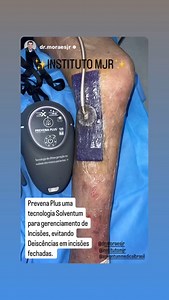 Solventum Medical on Reels