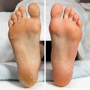 156K views · 841 reactions | The ultimate pedicure transformation✨ | MetDaan Tips | Facebook