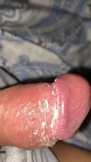 Làm sạch cặc cho cậu nào lũ chóCome clean my cheesy cock#gay #gayporn #gaykink #kinky #bdsm #slave #smegma #dickcheese #dirtycock #cheesydick #cặcbựa