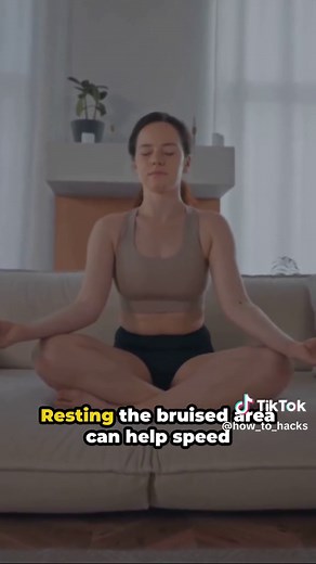 10 Effective Ways to Get Rid of Bruises Faster