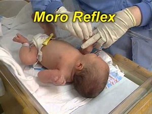 Motor Skills: Reflexes HQ