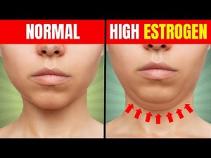 12 Signs You Have High Estrogen Levels In Your Body