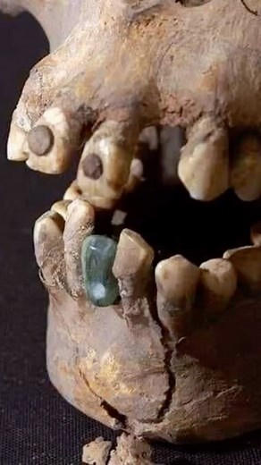 Burial of a woman at Teotihuacan with a jadeite tooth that was cemented or attached with fiber to her mandible. 350 to 450 AD. | Dentistry Zone