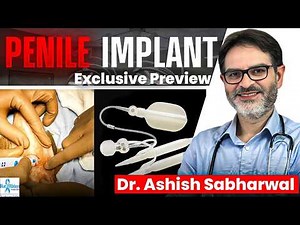 Penile Implant For Erectile Dysfunction | Risks, Benefits & Real Talk !!