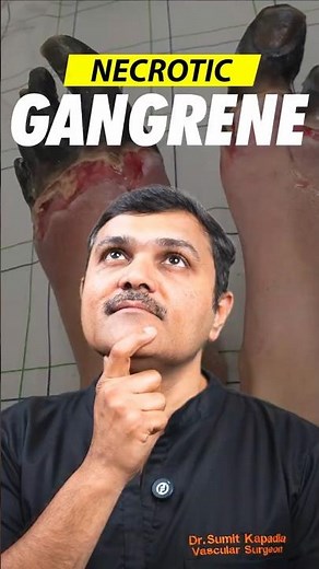 How Necrotic Gangrene Destroys Your Flesh 😱 #shorts