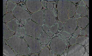Human Endothelial Progenitor Cells in vitro tube forming analysis using Lens Free Microscopy - Gilles Carpentier Research Web Site: Computer Image Analysis