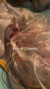 9.1K views · 155 reactions | My God is amazing ❤️ | Learn Medical | Facebook