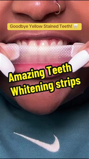 Goodbye yellow stained teeth✌🏽😘 #teethcare #teethtok #teethwhiteningstrips #musthaveproducts #fy