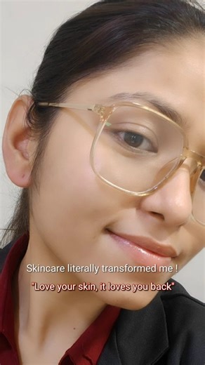 Vinibee l Skincare, Beauty & Cosmetic on Instagram: "From hiding my face to embracing my glow ✨ 🌟 My acne journey wasn't easy, but discovering the power of consistent skincare changed everything. 🌟 Remember, it's not just about the products—it's about loving and caring for your skin every single day. 🌿 Skincare, Acne journey, acne prone skin, content creator, Acne , skin transformation #skincare #skincareaddict #contentcreator #reels #reelitfeelit #viralreels #explorepage #vinibee #acneprones