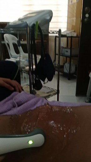 Tibia Plateau therapy Leg fractured 🦵 journey Deep bone healing #labanLangTaSelf | Ronela Benigay