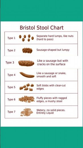 What Does the Bristol Stool Chart Indicate About Healthy Bowel Movements?