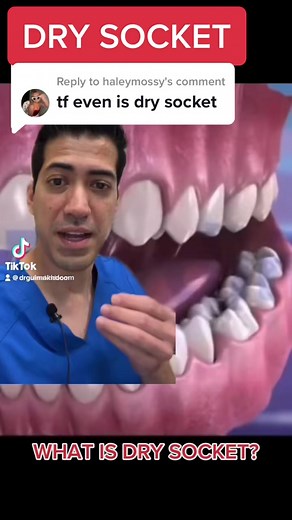 #drysocket #drysocketsucks #drysockettreatment #drysockets #drysocketwho #wisdomtoothrecovery #wisdomteeth #wisdomtooth #wisdomtoothextraction | Random Tooth Guy