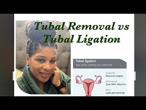 I had my tubes REMOVED! Tubal Removal vs Tubal Ligation