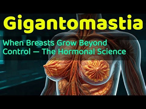 Gigantomastia: When Breasts Grow Beyond Control — The Hormonal Science