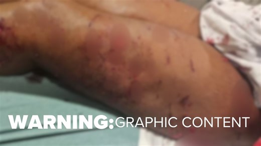 CMPD charges owner of dogs that attacked women in University City