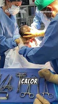Pasos importantes en la reanimación neonatal