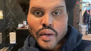 The Weeknd impacta con la transformación de su rostro