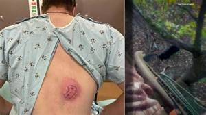 Bear climbs tree to gnaw on hunter in deer stand