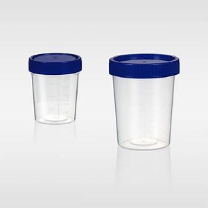 [Hot Item] Disposable Urine Measuring Cup Sample Collection Cup with ISO