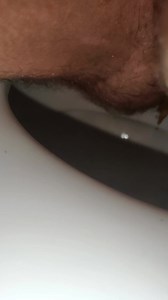 Diarrhea explosion after eating sugar free candies