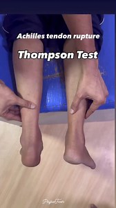 🦵 Thompson Test – Achilles Tendon Rupture Detection A simple yet powerful clinical test to identify a complete Achilles tendon rupture. How it works: The patient lies prone with feet off the edge of the bed. The examiner squeezes the calf muscle — no plantarflexion = positive sign = Achilles tendon rupture. Follow for more clinical pearls in physiotherapy. | PhysioFixers