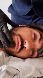 Temporomandibular joint Disorder #tmj #tmjtreatment #temporomandibular #dentistry #dentistaentiktok #dentista #chiropractor #chiropractortiktok #fyp #fypage #neiperte #duetwithme #duet #viraltiktok | Il Doc Osteopata