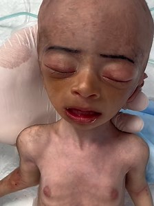 baby brain damage 😭#usa🇺🇸 #notcryafterdelivery | baby