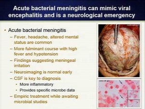 clinical approach to encephalitis