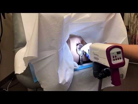 Colposcopy training video