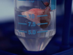 맹장 결찰 및 마우스에서 autophagy에 공부를 모델로 패혈증 관통 유도