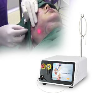 [Hot Item] 지방흡입기 바세르 지방 제거 림프종 미용 기계 지방흡입 얼굴 리프팅 수술 기계