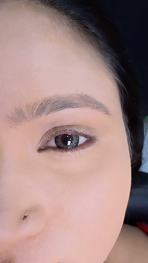 Eye crease how to remove | Rekha Damor