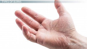 You must c C reate an account to continue watching