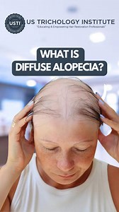 Unraveling the Hair Loss Mystery of Diffuse Alopecia . . . #HairLoss #Alopecia #Baldness #HairGrowth #HairRestoration #HairTransplant #ThinningHair #HairTreatment #HairCare #Balding | United States Trichology Institute | Facebook